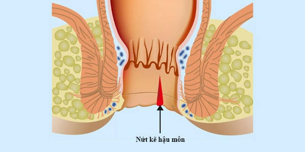 Chua-nut-ke-hau-mon