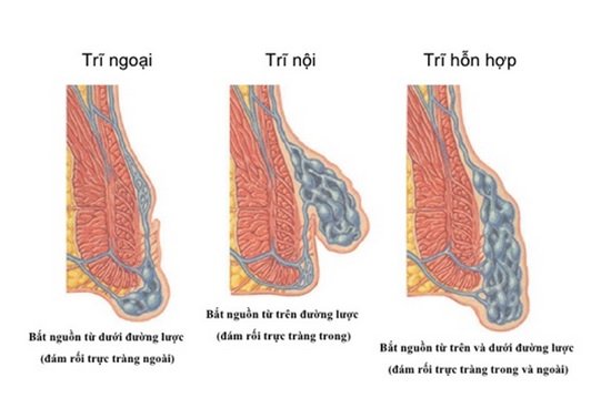 benh tri 1 - cac loai tri