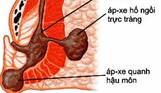 ap-xe-hau-mon-123_1