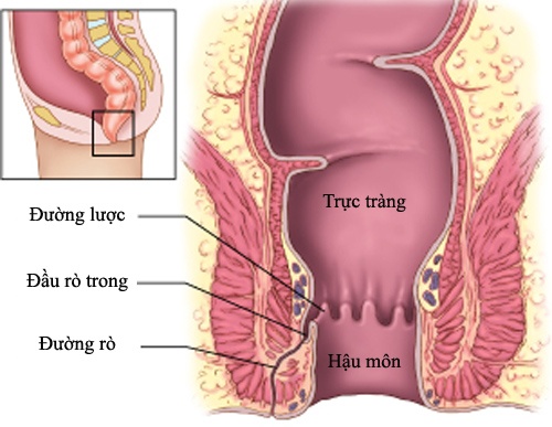 noi-am-anh-mang-ten-benh-ro-hau-mon-1