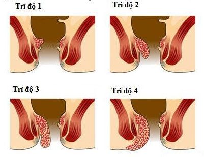 tri cac do_5