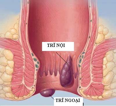 tri-noi-tri-ngoai