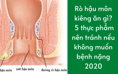 Bệnh rò hậu môn kiêng ăn gì? 5 thực phẩm nên tránh nếu không muốn bệnh nặng