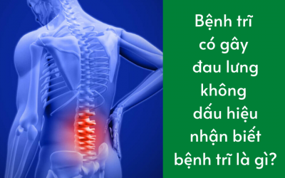 Bệnh trĩ có gây đau lưng không dấu hiệu nhận biết bệnh trĩ là gì?