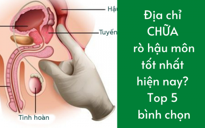 Địa Chỉ Chữa Rò Hậu Môn Ở Đâu Tốt Nhất Hiện Nay? Top 5 Bình Chọn 2021
