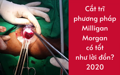 Cắt trĩ bằng phương pháp Milligan Morgan có tốt như lời đồn?