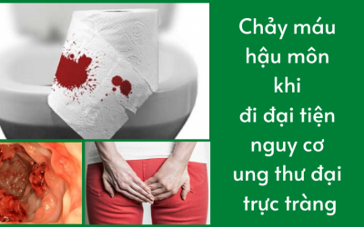 Chảy máu hậu môn khi đi đại tiện nguy cơ ung thư đại trực tràng