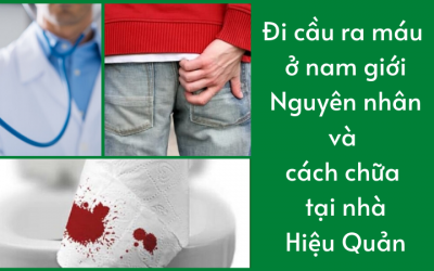 Đi cầu ra máu ở nam giới: Nguyên nhân và cách chữa tại nhà