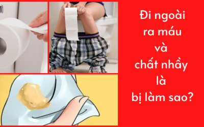 Đi ngoài ra máu và chất nhầy là bị làm sao [Cảnh báo]