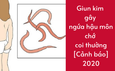 Giun kim gây ngứa hậu môn chớ coi thường [Cảnh báo]