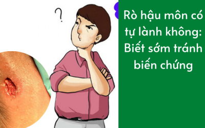 Rò hậu môn có tự lành không: Biết sớm tránh biến chứng