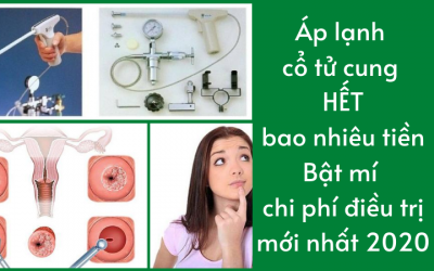 Áp lạnh cổ tử cung hết bao nhiêu tiền: Bật mí chi phí điều trị mới nhất 2021