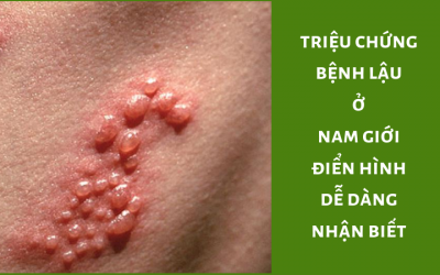 { Triệu Chứng Bệnh Lậu Ở Nam Giới } Dấu Hiệu Nhận Biết Điển Hình