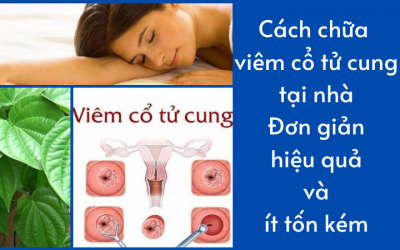 Cách chữa viêm cổ tử cung tại nhà: Đơn giản, hiệu quả và ít tốn kém
