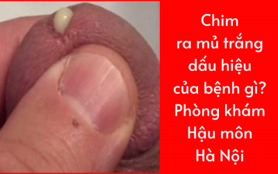 Chim ra mủ trắng là dấu hiệu của bệnh gì?