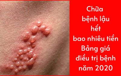 { Chữa Bệnh Lậu Hết Bao Nhiêu Tiền } –  Bảng Giá Năm 2021