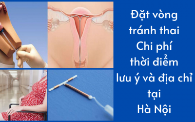 { Đặt vòng tránh thai } Chi phí, thời điểm và địa chỉ đặt vòng ở Hà Nội