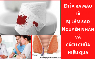 Đi ỉa ra máu là bị làm sao: Nguyên nhân và cách khắc phục hiệu quả