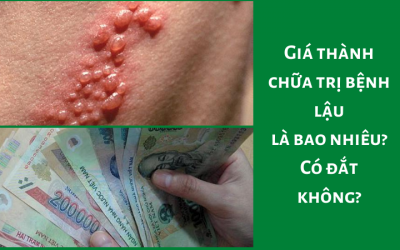 Giá thành chữa trị bệnh lậu là bao nhiêu? Có đắt không?
