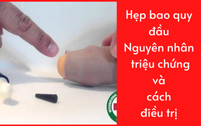 Hẹp bao quy đầu: Nguyên nhân, triệu chứng và cách điều trị