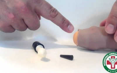 8 tác hại của hẹp bao quy đầu mà nam giới không ngờ tới