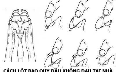 Có Nên Lột Bao Quy đầu Khi Mặc Quần Không? Vấn đề Cần Biết