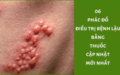 06 Phác Đồ Điều Trị Bệnh Lậu Bằng Thuốc Cập Nhật Mới Nhất