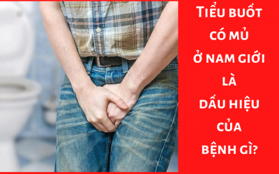 Tiểu buốt có mủ ở nam giới là dấu hiệu của bệnh gì?