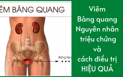 Viêm bàng quang: Nguyên nhân, triệu chứng và cách điều trị