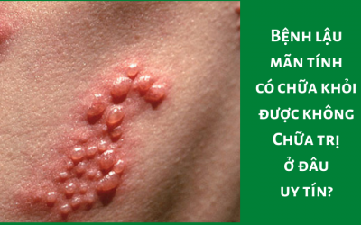 Bệnh lậu mãn tính có chữa khỏi được không – Chữa trị ở đâu uy tín?