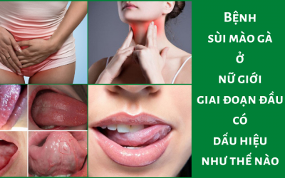 Bệnh sùi mào gà ở nữ giới giai đoạn đầu có dấu hiệu như thế nào