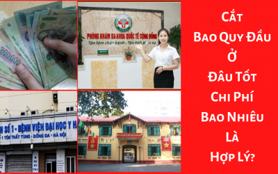 Cắt Bao Quy Đầu Ở Đâu Tốt – Chi Phí Bao Nhiêu Là Hợp Lý?