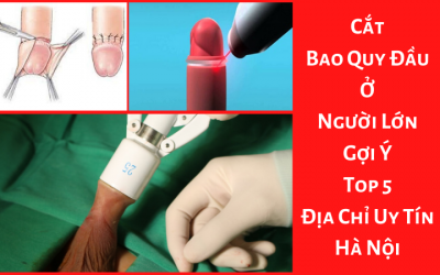 Cắt Bao Quy Đầu Ở Người Lớn – Gợi Ý Top 5 Địa Chỉ Uy Tín Hà Nội