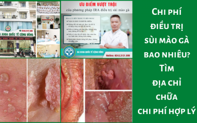 Chi phí điều trị sùi mào gà bao nhiêu? Tìm địa chỉ chữa chi phí hợp lý