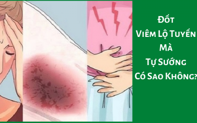 Đốt Viêm Lộ Tuyến Mà Tự Sướng Có Sao Không?