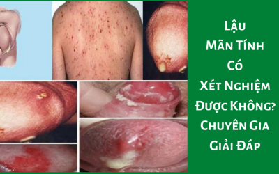 Lậu Mãn Tính Có Xét Nghiệm Được Không? Chuyên Gia Giải Đáp