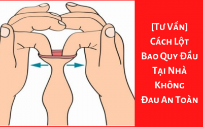 [Tư Vấn] Cách Lột Bao Quy Đầu Tại Nhà Không Đau An Toàn