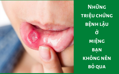 Những triệu chứng bệnh lậu ở miệng bạn không nên bỏ qua