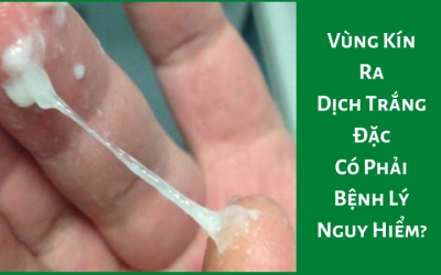 Vùng Kín Ra Dịch Trắng Đặc Có Phải Bệnh Lý Nguy Hiểm?