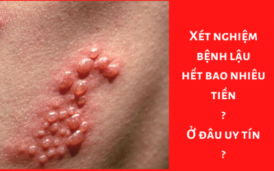 Xét Nghiệm Bệnh Lậu Hết Bao Nhiêu Tiền? Ở Đâu Uy Tín?