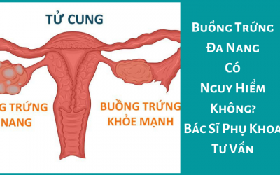Buồng Trứng Đa Nang Có Nguy Hiểm Không? Bác Sĩ Phụ Khoa Tư Vấn