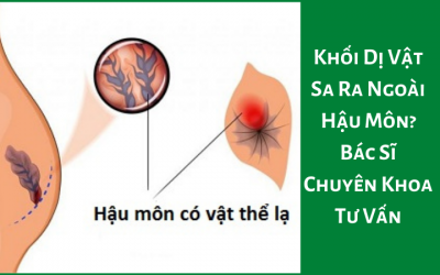 Khối Dị Vật Sa Ra Ngoài Hậu Môn? Bác Sĩ Chuyên Khoa Tư Vấn