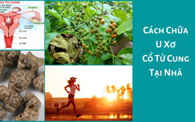 [ Cách Chữa U Xơ Cổ Tử Cung Tại Nhà ] – Chuyên Khoa Tư Vấn