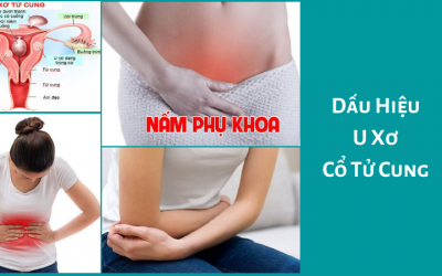 [ Dấu Hiệu U Xơ Cổ Tử Cung ] – Danh Sách 10 Biểu Hiện Thường Gặp