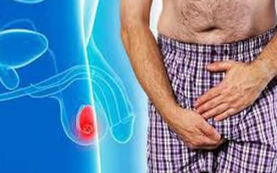 Đau Nhức Tinh Hoàn Có Nguy Hiểm Không? – 9 Nguyên Nhân Gây Ra