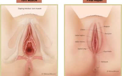 Bài Tập Kegel Để Thu Nhỏ Cô Bé Hiệu Quả Tại Nhà