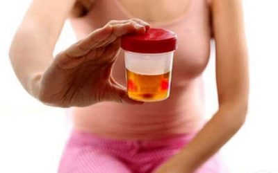 Top 10 Cách Chữa Tiểu Ra Máu Ở Nữ Giới Hiệu Quả