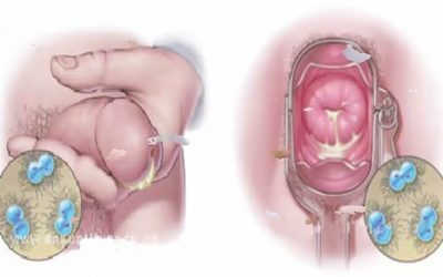 [TỔNG HỢP] Chữa bệnh lậu mãn tính ở đâu? 5 địa chỉ tại Hà Nội