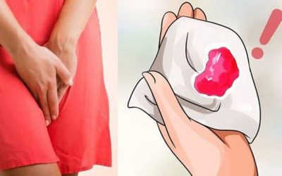 12 dấu hiệu sắp có kinh nguyệt phái đẹp chớ bỏ qua