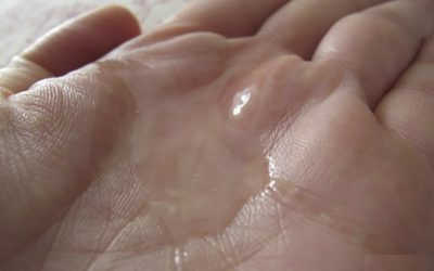 Giải đáp: Tinh trùng màu gì thì tốt, màu sắc bất thường tinh trùng thế nào?